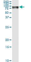 Anti-GLB1 Antibody Pair