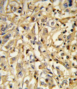 Anti-IL21 Rabbit Polyclonal Antibody