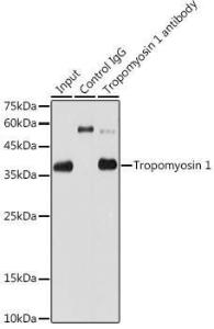 Immunoprecipitation analysis of 600 µg extracts of rat heart cells using 3 µg of Anti-Tropomyosin 1 (alpha) Antibody [ARC1283] (A306724). This Western blot was performed on the immunoprecipitate using Anti-Tropomyosin 1 (alpha) Antibody [ARC1283] (A306724) at a dilution of 1:1000