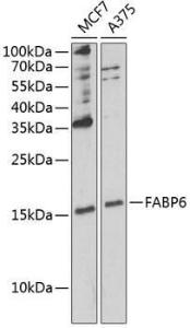 Western blot analysis of extracts of various cell lines, using Anti-FABP6 Antibody (A12036) at 1:1,000 dilution. The secondary antibody was Goat Anti-Rabbit IgG H&L Antibody (HRP) at 1:10,000 dilution.