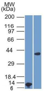 Western blot analysis of (A) recombinant ARG1 protein fragment and (B) human liver lysate using Anti-Arginase 1 Antibody [ARG1/1125]