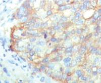 Anti-KARS Mouse Monoclonal Antibody [clone: 8G12C1]