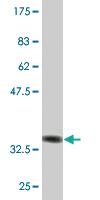 Anti-TSC22D3 Mouse Monoclonal Antibody [clone: 2B2]