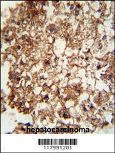 Anti-ITGAM Rabbit Polyclonal Antibody (AP (Alkaline Phosphatase))