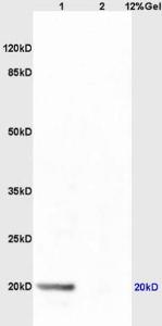 Anti-DUT Rabbit Polyclonal Antibody