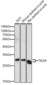 Western blot analysis of extracts of various cell lines, using Anti-TIGAR Antibody (A306725) at 1:1,000 dilution. The secondary antibody was Goat Anti-Rabbit IgG H&L Antibody (HRP) at 1:10,000 dilution.