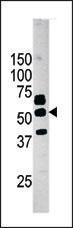 Anti-Pantothenate Kinase 2, Mitochondrial Rabbit Polyclonal Antibody (Biotin)