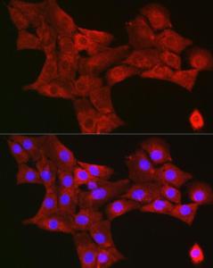 Immunofluorescence analysis of NIH/3T3 cells using Anti-TIGAR Antibody (A306725) at a dilution of 1:200 (40x lens). DAPI was used to stain the cell nuclei (blue).