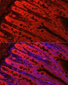 Immunofluorescence analysis of mouse small intestine cells using Anti-FABP6 Antibody (A12036) at a dilution of 1:200 (40x lens). DAPI was used to stain the cell nuclei (blue). Perform high pressure antigen retrieval with 10 mM citrate buffer pH 6.0 before commencing with IF staining protocol.