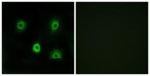 Immunofluorescence analysis of A549 cells using Anti-ABHD6 Antibody The right hand panel represents a negative control, where the antibody was pre-incubated with the immunising peptide