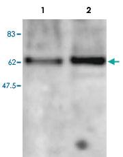 Anti-MBD2 Rabbit Polyclonal Antibody