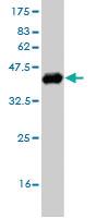 Anti-OTX1 Mouse Monoclonal Antibody [clone: 4E5]