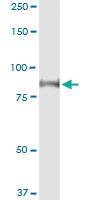 Anti-GLB1 Polyclonal Antibody Pair