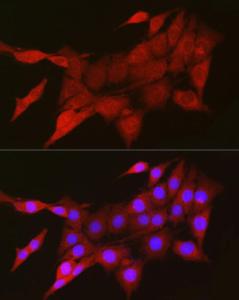 Immunofluorescence analysis of PC-12 cells using Anti-TIGAR Antibody (A306725) at a dilution of 1:200 (40x lens). DAPI was used to stain the cell nuclei (blue).