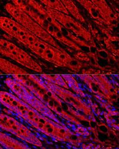 Immunofluorescence analysis of rat small intestine cells using Anti-FABP6 Antibody (A12036) at a dilution of 1:200 (40x lens). DAPI was used to stain the cell nuclei (blue). Perform high pressure antigen retrieval with 10 mM citrate buffer pH 6.0 before commencing with IF staining protocol.