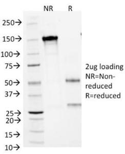 SDS-PAGE analysis of Anti-Arginase 1 Antibody [ARG1/1125] under non-reduced and reduced conditions; showing intact IgG and intact heavy and light chains, respectively. SDS-PAGE analysis confirms the integrity and purity of the antibody.