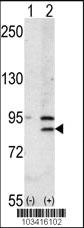 Anti-BRD2 Rabbit Polyclonal Antibody