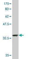 Anti-NDUFA2 Mouse Monoclonal Antibody [clone: 6E7]