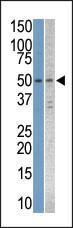 Anti-STK38L Rabbit Polyclonal Antibody (FITC (Fluorescein))