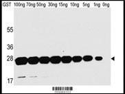 Anti-Glutathione S Transferase Mouse Monoclonal Antibody (FITC (Fluorescein Isothiocyanate)) [clone: 21CT54.13.1 / 21CT54.13.7]