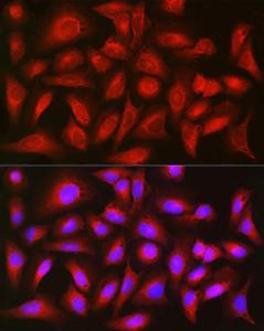 Immunofluorescence analysis of U2OS cells using Anti-TIGAR Antibody (A306725) at a dilution of 1:200 (40x lens). DAPI was used to stain the cell nuclei (blue).