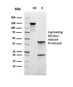 Antibody anti-VIMENTIN VIM6430R 100 µg