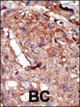 Anti-BRD2 Rabbit Polyclonal Antibody