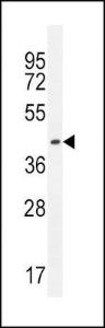 Anti-IGHG1 Rabbit Polyclonal Antibody (HRP (Horseradish Peroxidase))