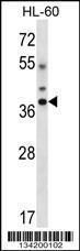 Anti-DLX5 Rabbit Polyclonal Antibody (FITC (Fluorescein Isothiocyanate))