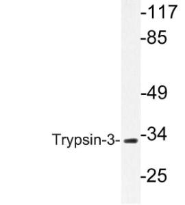 Western blot analysis of lysate from A549 cells using Anti-Trypsin-3 Antibody