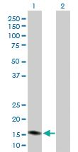 Anti-PGF Rabbit Polyclonal Antibody