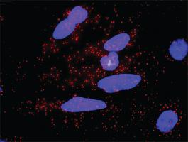 Anti-EIF4EBP1 Antibody Pair