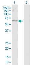 Anti-ARRB1 Rabbit Polyclonal Antibody