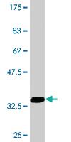 Anti-CPT1A Mouse Monoclonal Antibody [clone: 1D3]