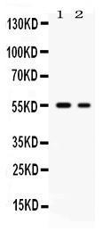 Anti-SLC2A5 Antibody