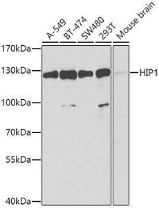 Anti-HIP1 antibody