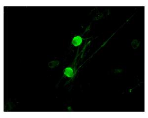 p75NTR staining (green) in rat trigeminal ganglion cells by Immunocytochemistry. Primary antibody dilution: 1:100. Image courtesy of QBM Cell Science.