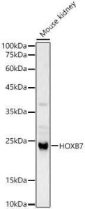 Antibody anti-HOXB7 100 µl