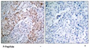 Anti-ERBB2 Rabbit Polyclonal Antibody