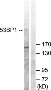 Anti-53BP1 Rabbit Polyclonal Antibody