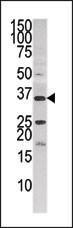 Anti-PANK3 Rabbit Polyclonal Antibody (AP (Alkaline Phosphatase))