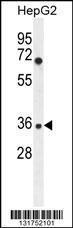 Anti-IGHG1 Rabbit Polyclonal Antibody (Biotin)