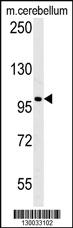 Anti-EPC2 Rabbit Polyclonal Antibody