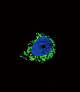 Anti-Insulin-Like Growth Factor Binding Protein 2 Rabbit Polyclonal Antibody (PE (Phycoerythrin))