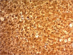 Anti-Arginase 1 Mouse Monoclonal Antibody [clone: ARG1/1126]