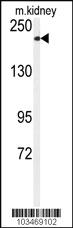 Anti-TRPM7 Rabbit Polyclonal Antibody