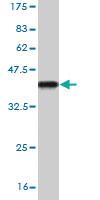 Anti-OTX1 Mouse Monoclonal Antibody [clone: 3D12]