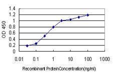 Anti-TSC22D3 Mouse Monoclonal Antibody [clone: 3A5]