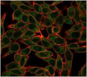 Immunofluorescent analysis of MCF-7 cells stained with Anti-Bcl-6 Antibody [PCRP-BCL6-1E2]) followed by Goat Anti-Mouse IgG (CF&#174; 488) (Green). CF&#174; 640A Phalloidin (Red).