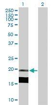 Anti-IL7 Mouse Polyclonal Antibody